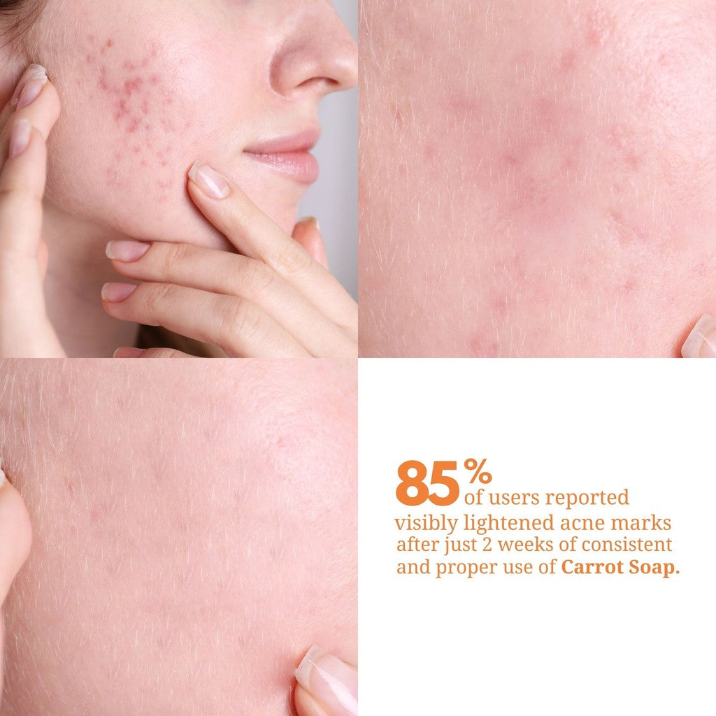 Real Skin Carrot Soap - Whitening and Moisturizing Soap with Free Mesh